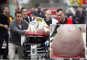 An injured person is evacuated outside the French satirical newspaper Charlie Hebdo's office, in Paris, Wednesday, Jan. 7, 2015. Police official says 11 dead in shooting at the French satirical newspaper. (AP Photo/Thibault Camus)